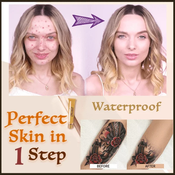 ElectroMatic depilator za vstavljanje dlak