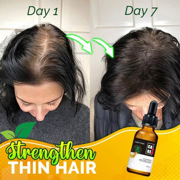 10X-Regro Strong serum za lase