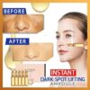 Ampula Instant Dark Spot Lifting