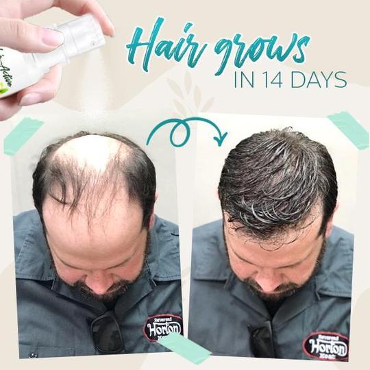 Hair-Active Root-Boost Ginger Spray - slika 2