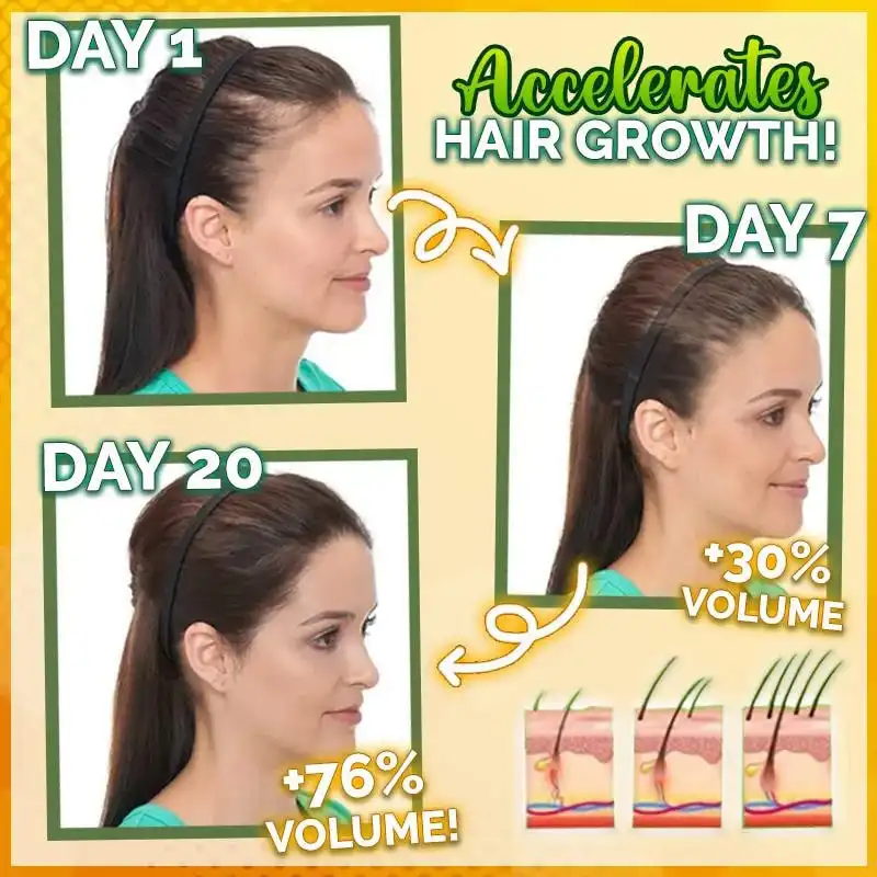 10X-Regro Strong serum za lase - slika 2