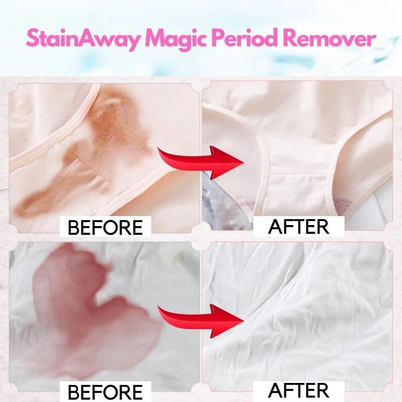StainAway Magic Period Remover - slika 3