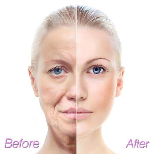 Ampulni serum - slika 4