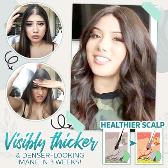 Hair-Active Root-Boost Ginger Spray - slika 4