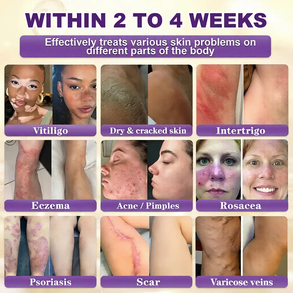 Biotin 10-v-1 krema za obnovo kože - slika 2