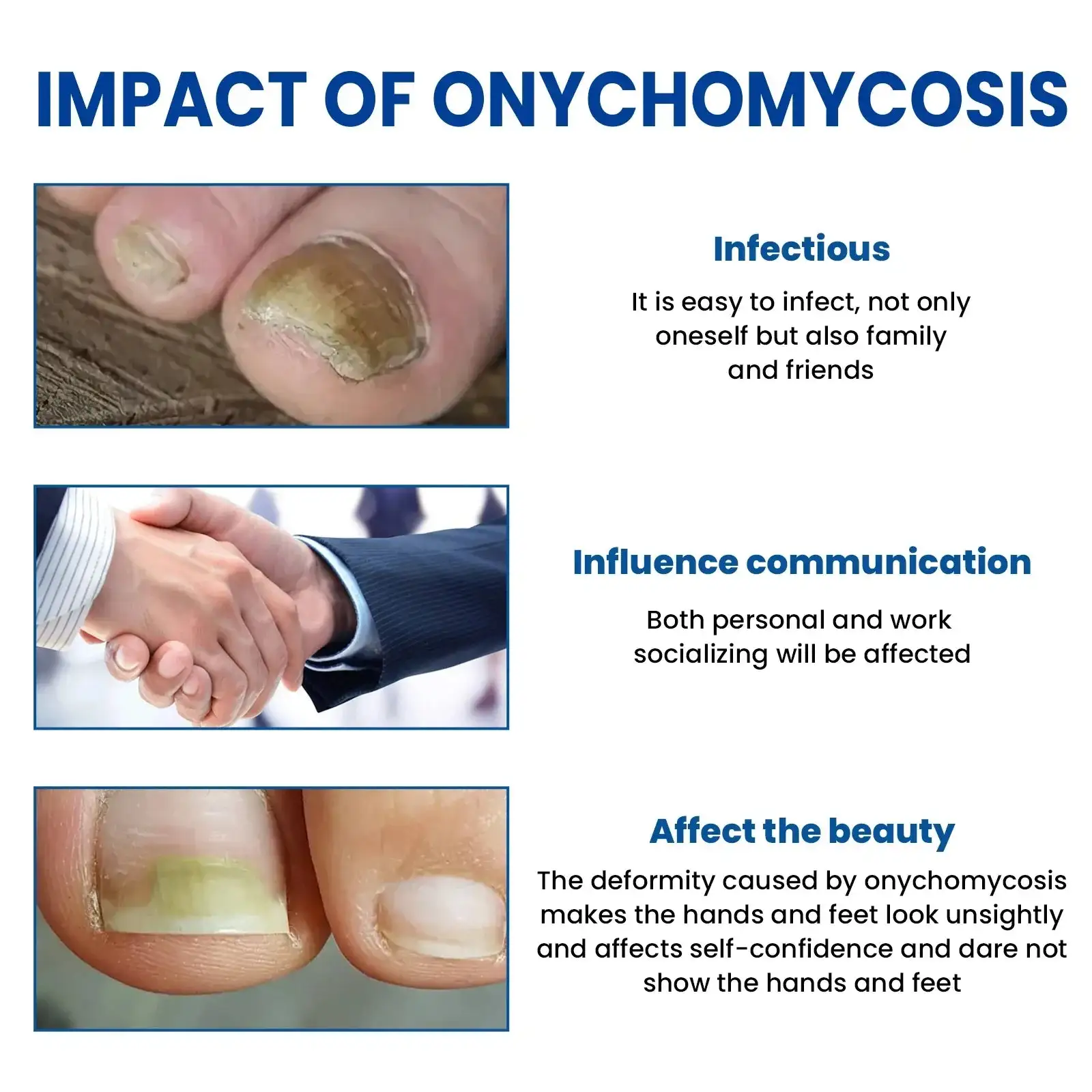 Obliži za popravilo glivic na nohtih - slika 2