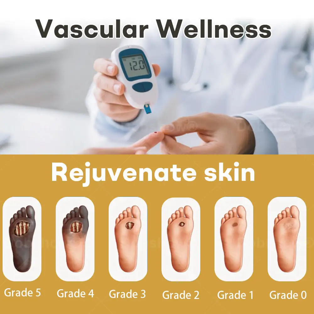 GlucoShield pršilo za rane s čebeljim strupom - slika 2