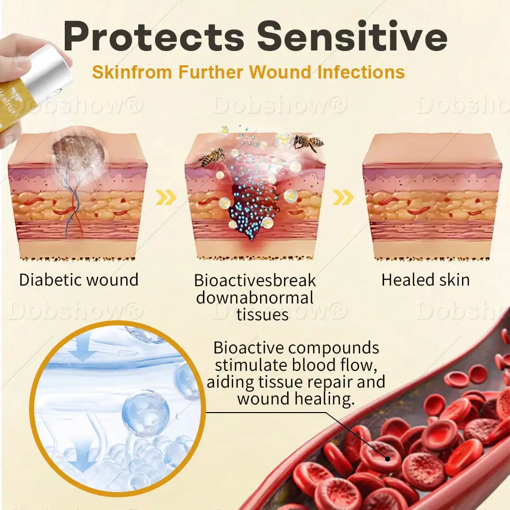 GlucoShield pršilo za rane s čebeljim strupom - slika 3