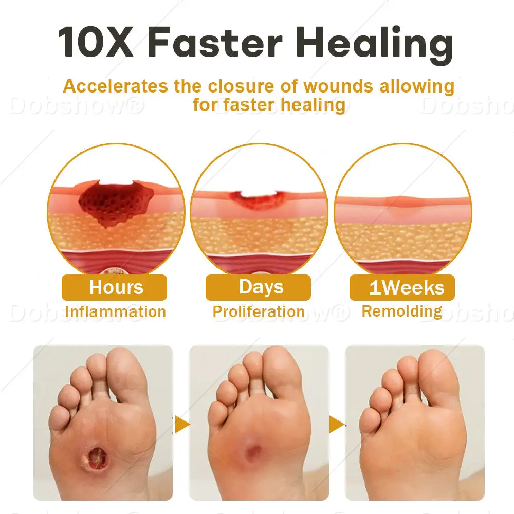 GlucoShield pršilo za rane s čebeljim strupom - slika 4