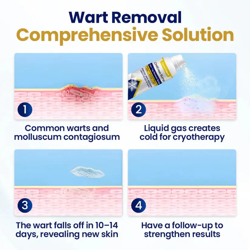 ChillErase Bump & Sprej za obnovo kožnih oznak - slika 4