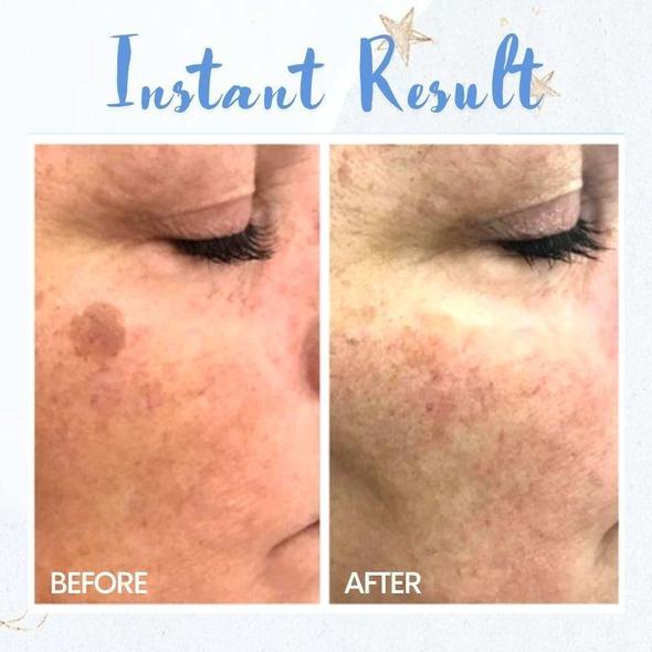 Pen za odstranjevanje madežev - slika 3