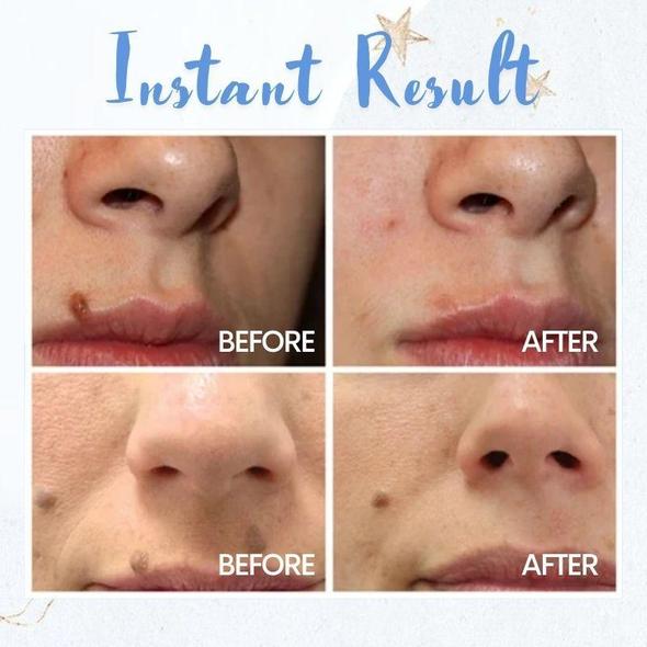 Pen za odstranjevanje madežev - slika 2