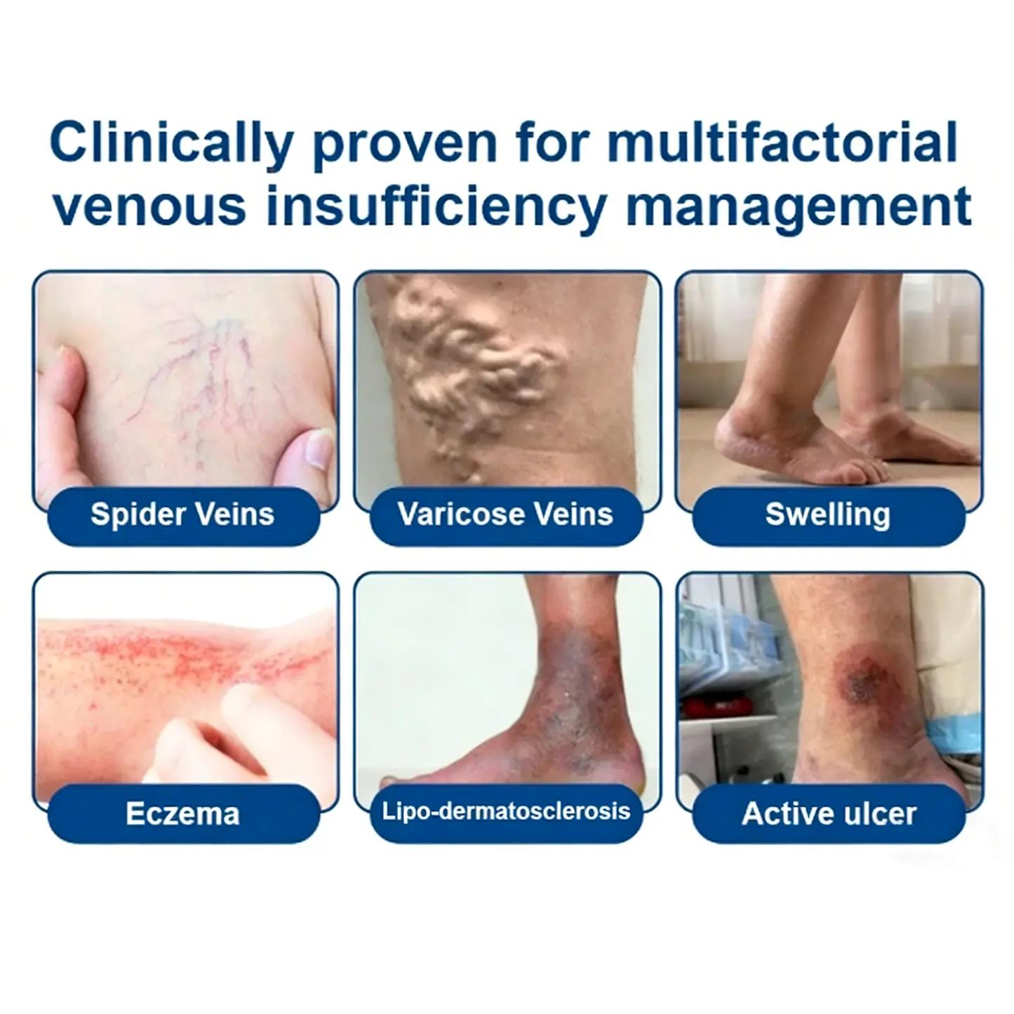 ๐ฝ๐ฒ๐ถ๐ฃ ๐พ๐จ๐ง๐๐ผ๐ช๐ง ๐๐๐๐ซ๐๐๐๐ฒ๐ฑ๐น๐ ๐๐๐ญ๐๐ - slika 3