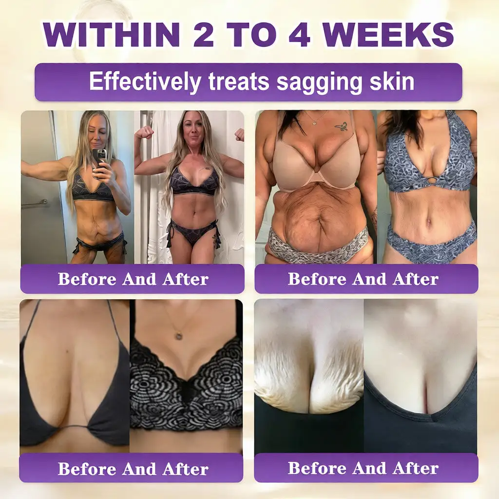 Biotin 10-v-1 krema za obnovo kože - slika 3