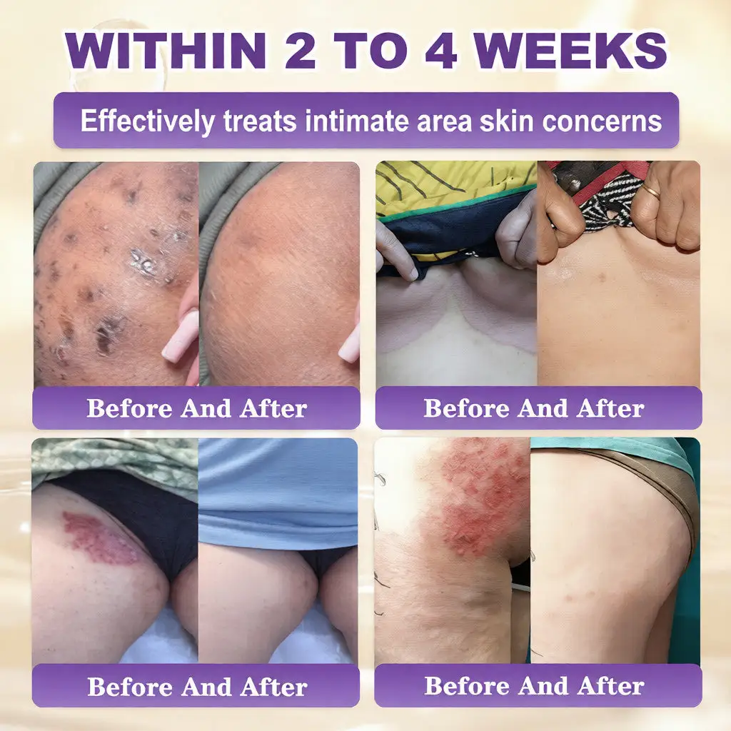 Biotin 10-v-1 krema za obnovo kože - slika 4