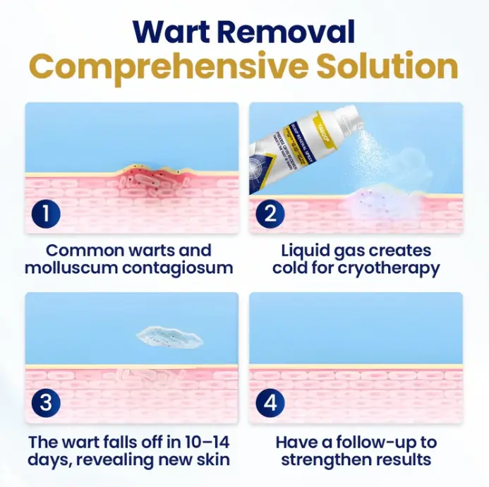 Chillique sprej za obnovo izboklin - slika 3